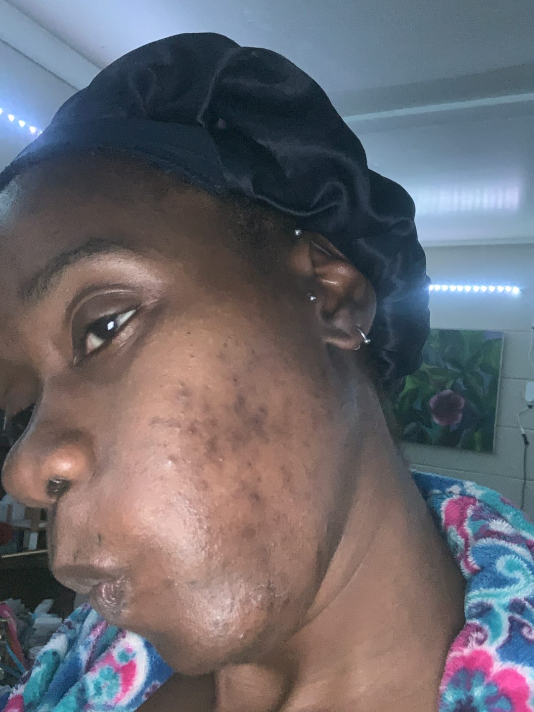 Customer photo review of Dark Spot Corrector Serum