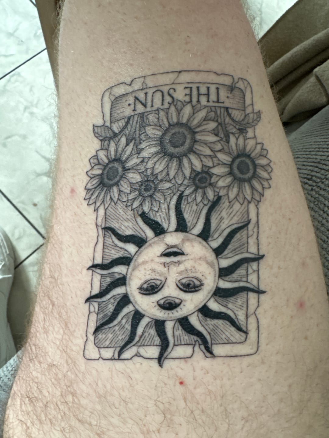Customer photo review of Easy Heal Balm
