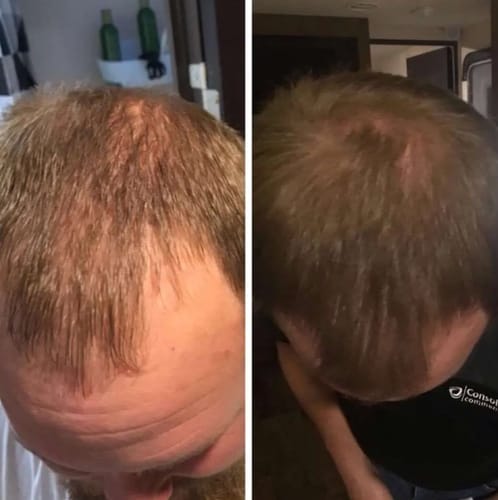 Customer photo review of HAIRGROWTH HAAR ÖL