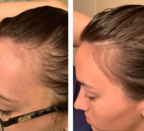 Customer photo review of HAIRGROWTH HAAR ÖL
