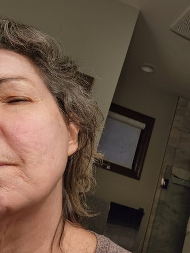 Customer photo review of Niacid