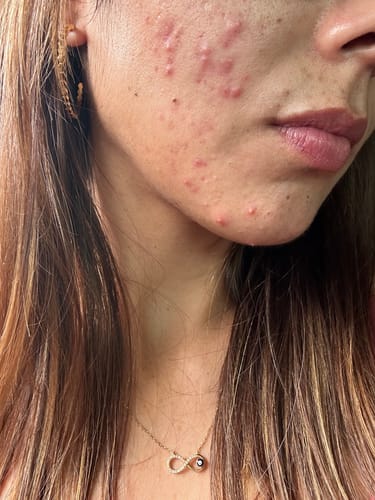 Customer photo review of Smooth Kit