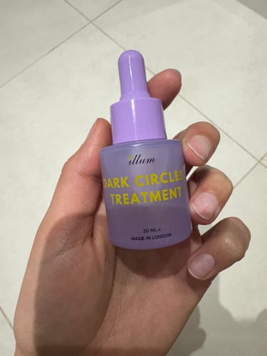 Customer photo review of Dark Circles Treatment