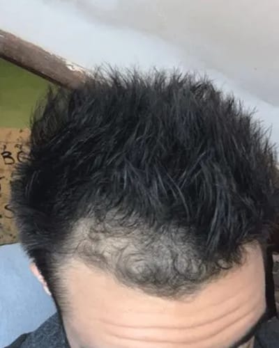 Customer photo review of HAIRGROWTH HAAR ÖL