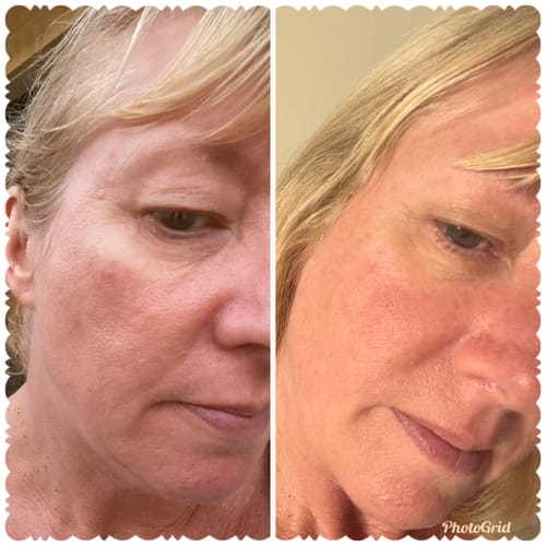 Customer photo review of Miracle Balm Tallow & Honey