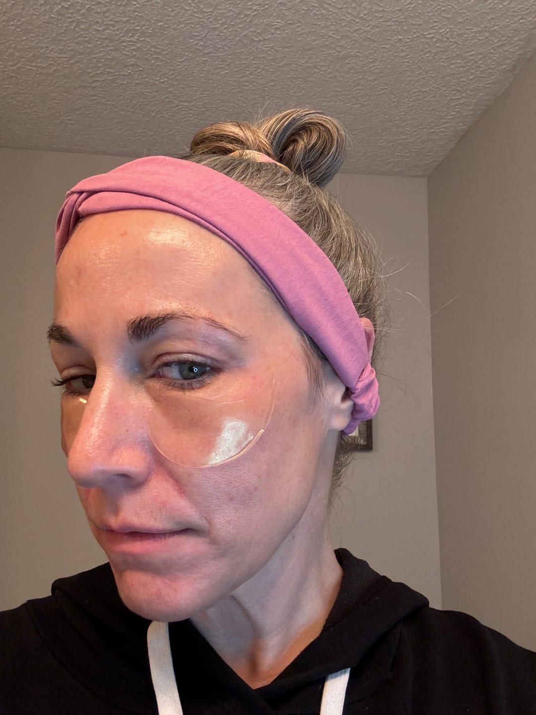 Customer photo review of 24 K Gold Collagen ++ Firming Eye Gels