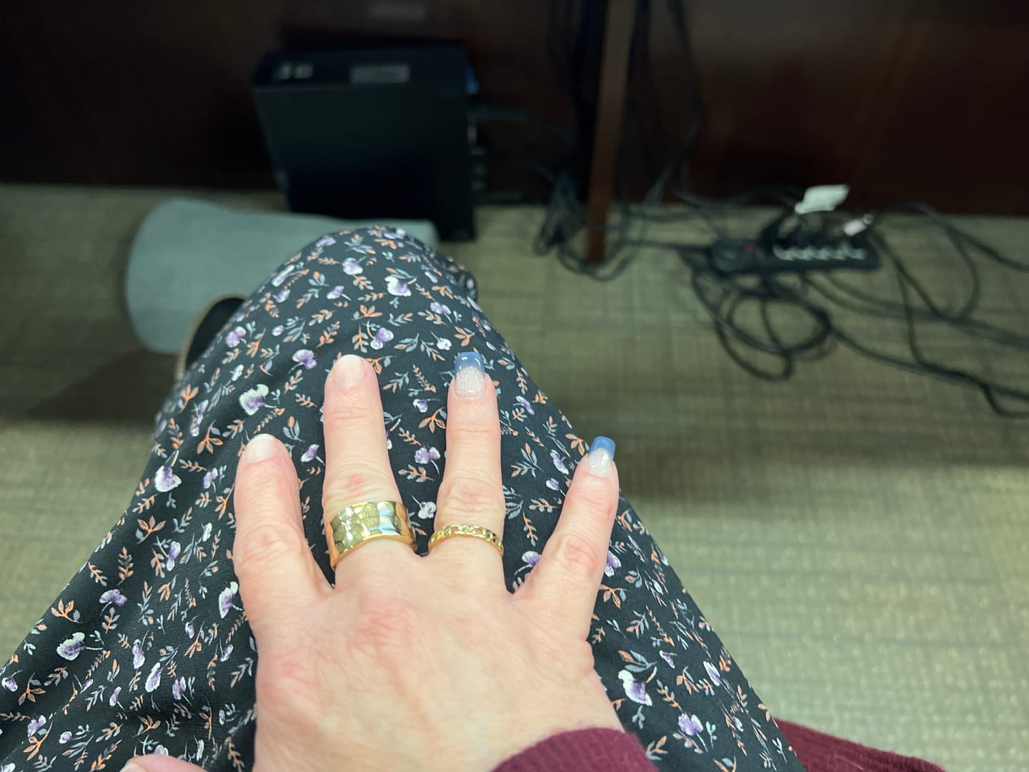 Customer photo review of Textured Band Ring
