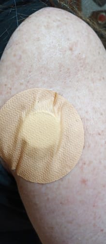 Customer photo review of Skin Grip MAX Freestyle Libre 2 Patches