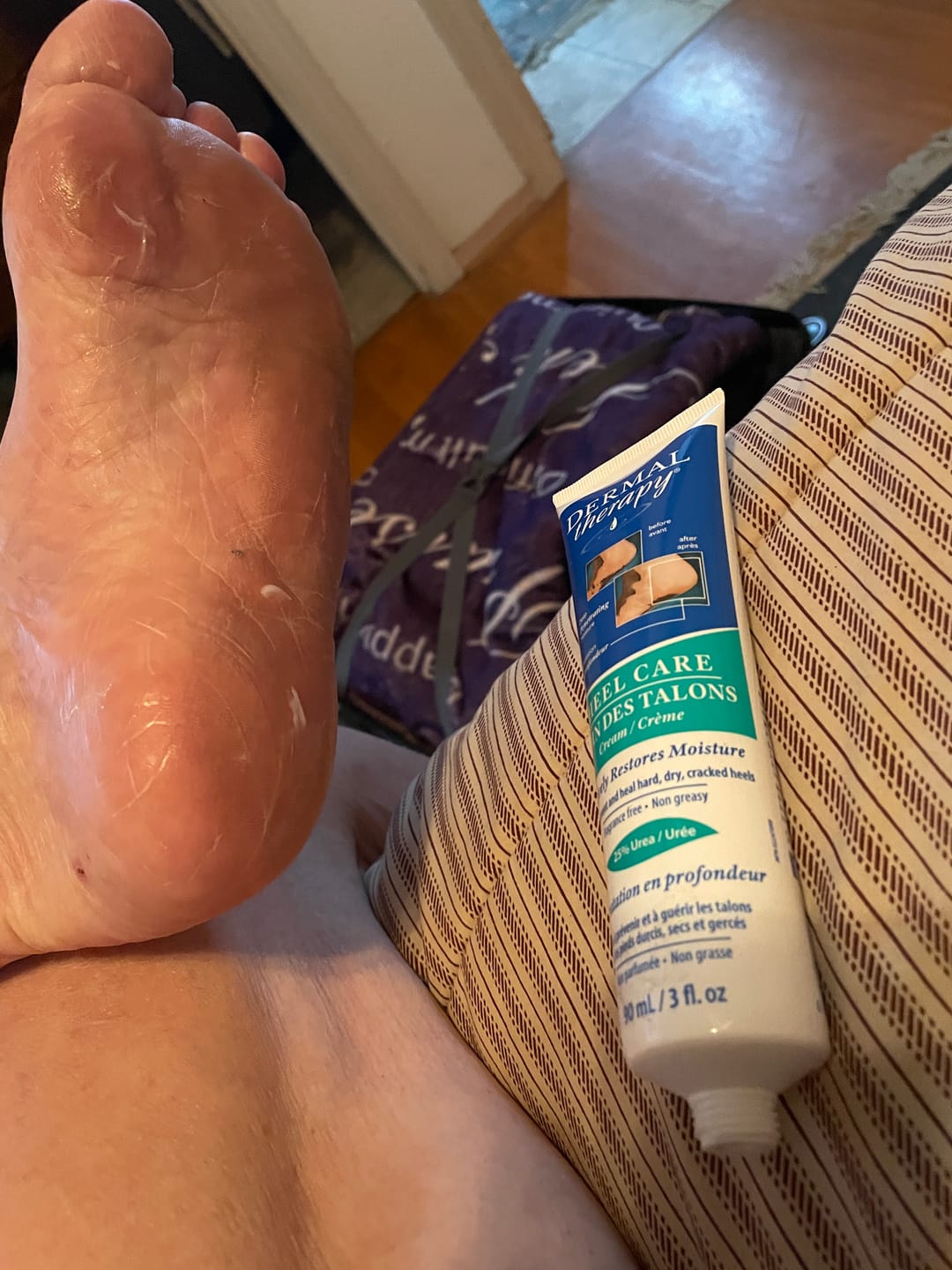 Customer photo review of Heel Care Cream