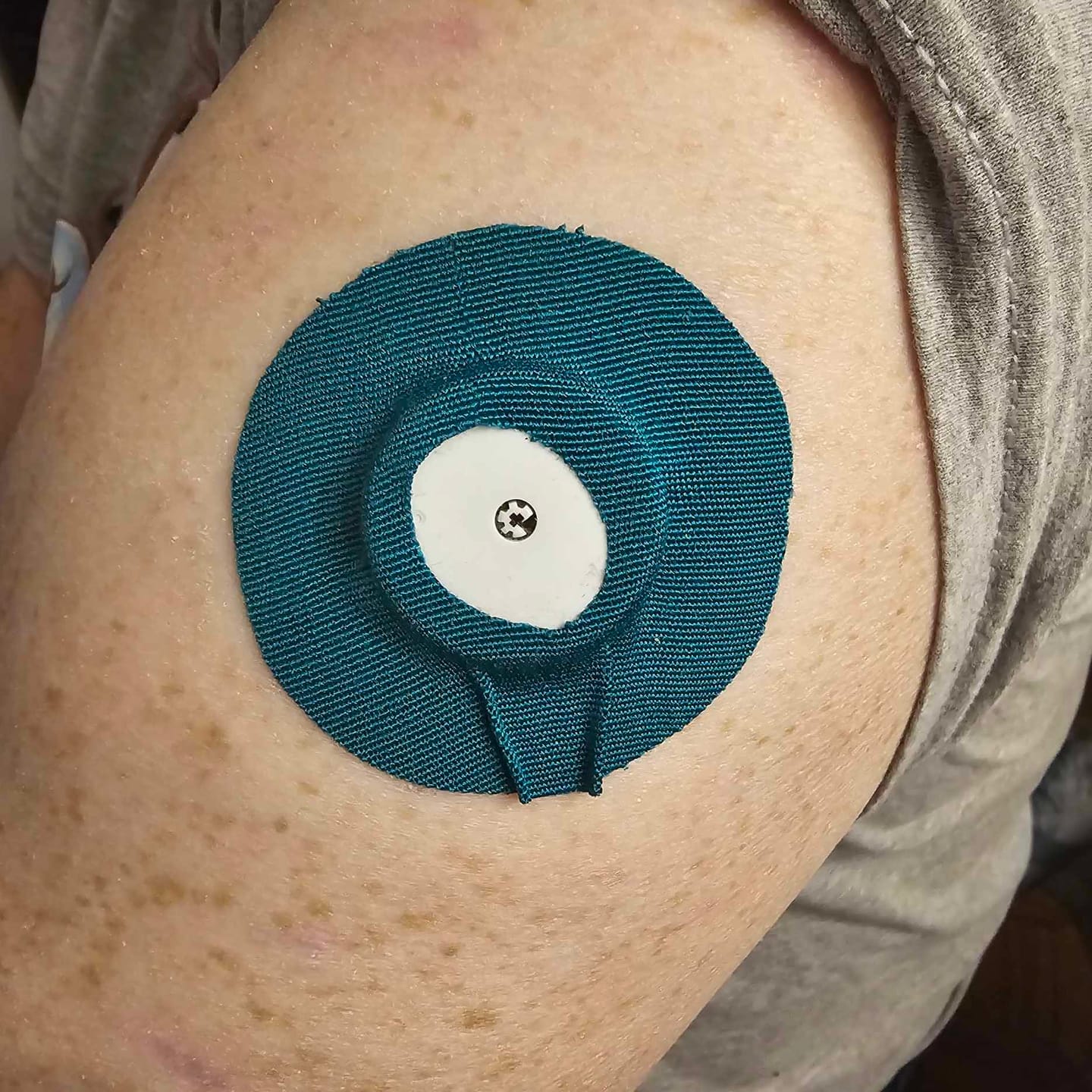 Customer photo review of Skin Grip Original - Universal Adhesive Patches (0.8 inch Hole)
