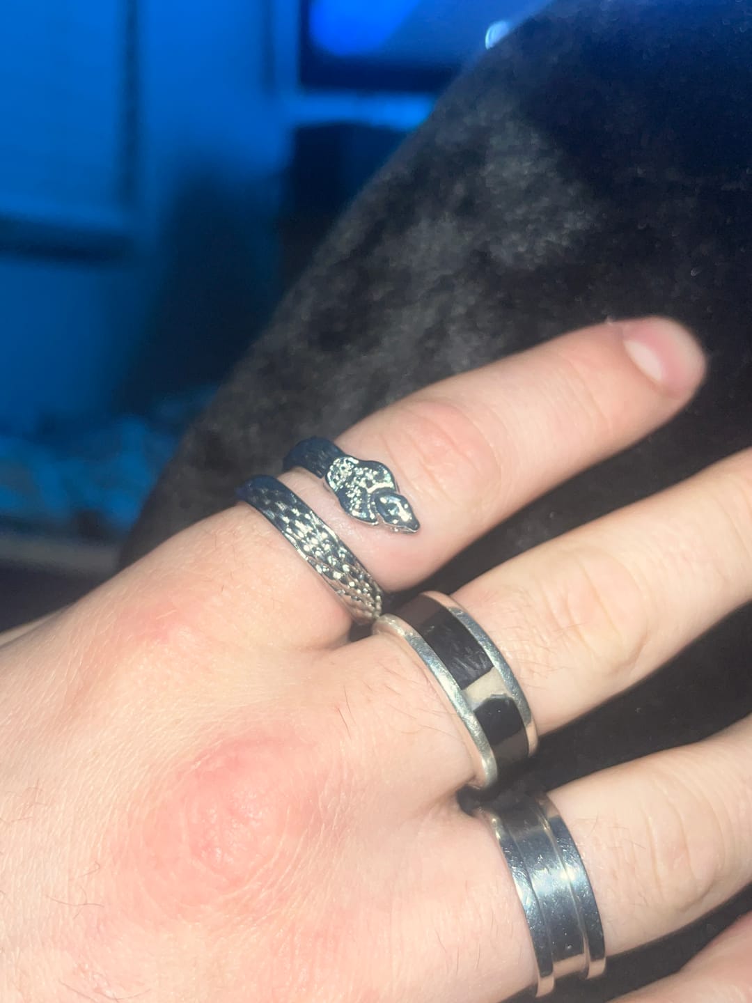 Customer photo review of UPGRADED SLIME RING