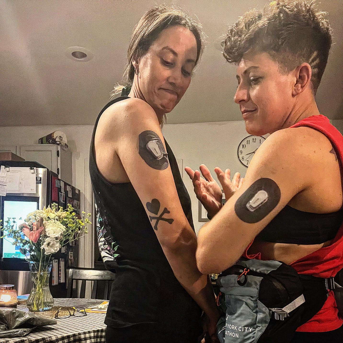 Customer photo review of Skin Grip MAX Dexcom G6 Patches