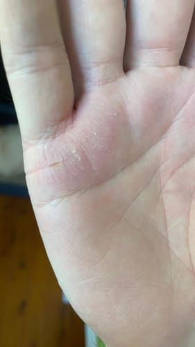 Customer photo review of B-Restore Barrier Cream