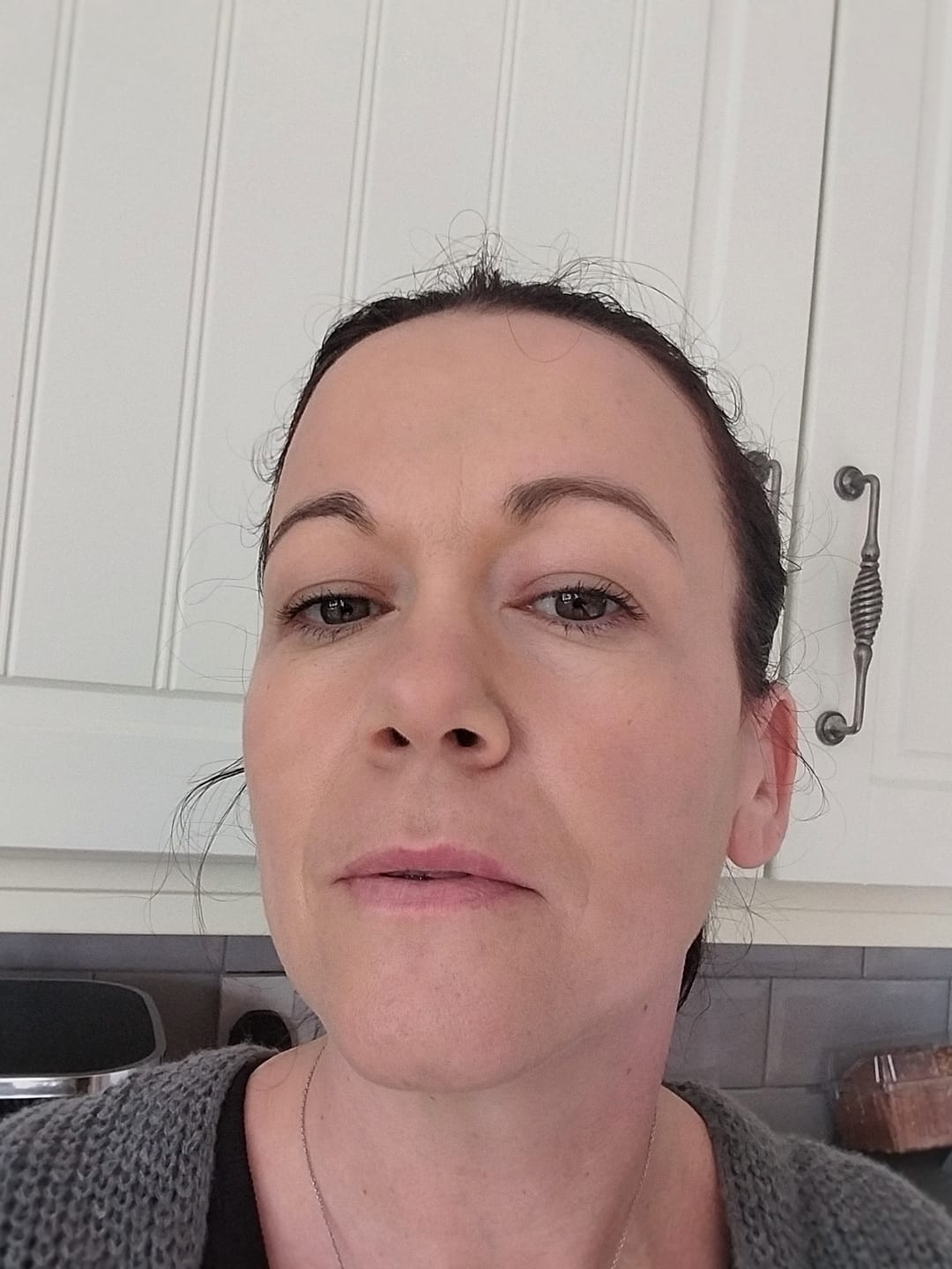 Customer photo review of Rosalique 3 in 1 Anti-Redness Miracle Formula SPF50