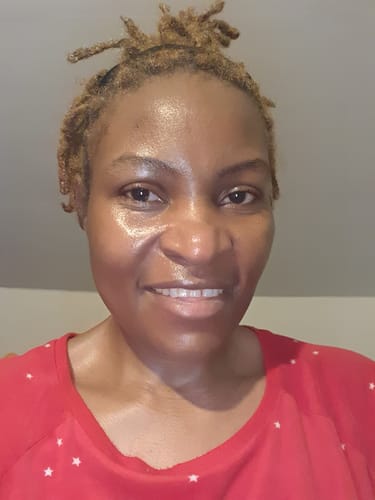 Customer photo review of Dark spots + Glow combo