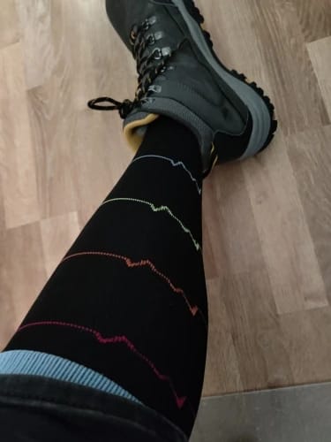 Customer photo review of Socky Mate™ Compression Socks