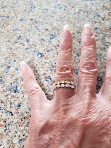 Customer photo review of Rocket Nail Fuel Nail Repair - Clear