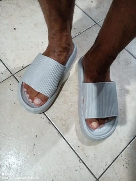 Customer photo review of The Snuggi Sandals