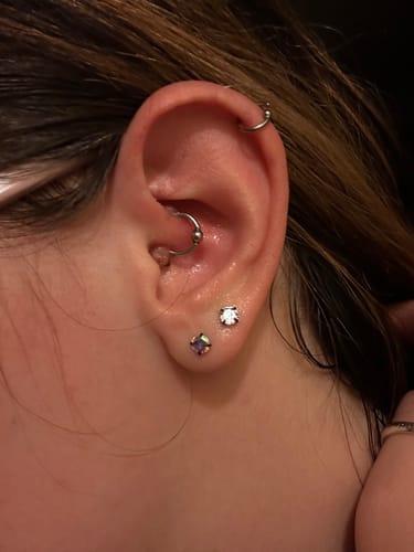 Customer photo review of Piercing Bump Treatment - Bump, Keloid & Scar Relief Oil
