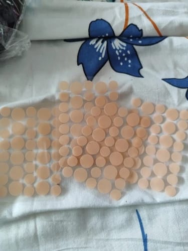 Customer photo review of Patchs anti boutons et acné