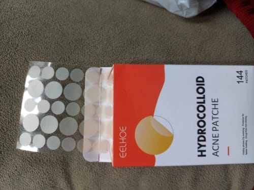 Customer photo review of Patchs anti boutons et acné