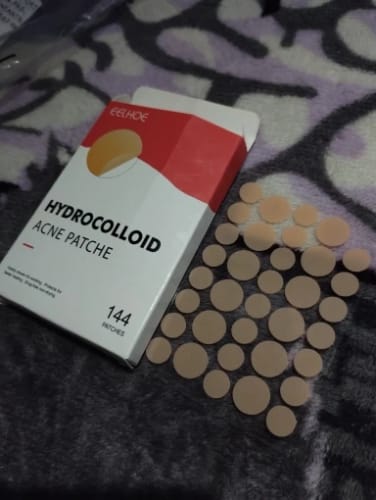 Customer photo review of Patchs anti boutons et acné