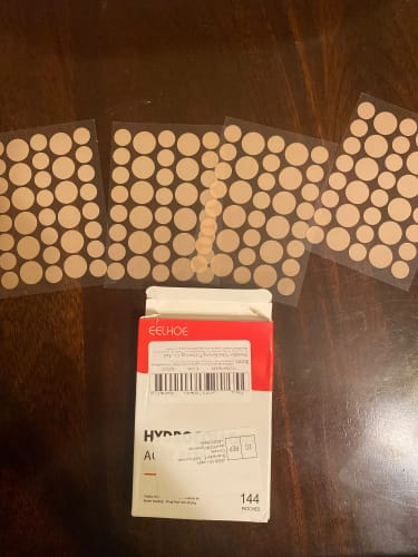 Customer photo review of Patchs anti boutons et acné