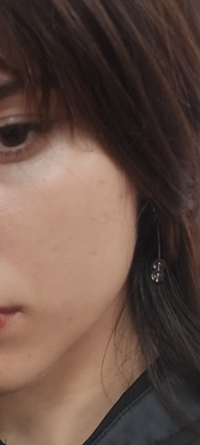 Customer photo review of Advanced Snail 96 Mucin Power Essence 100ml