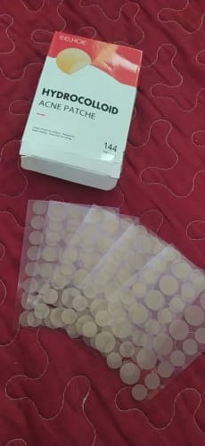 Customer photo review of Patchs anti boutons et acné
