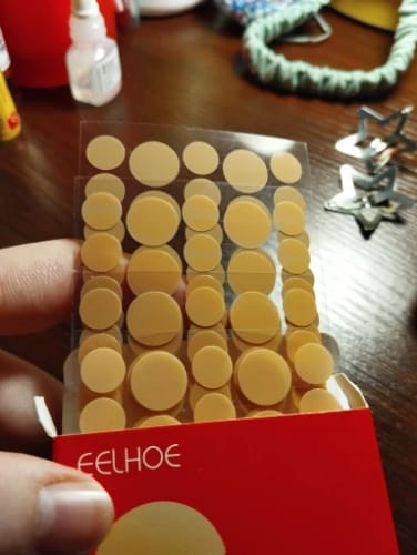 Customer photo review of Patchs anti boutons et acné