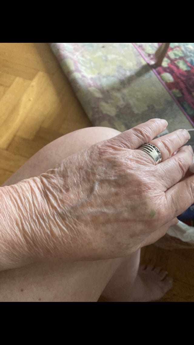 Customer photo review of Fisetin
