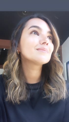 Customer photo review of KIT SUEROS FACIALES DÍA Y NOCHE CON CÉLULAS MADRE, COLÁGENO Y ÁCIDO HIALURÓNICO.
