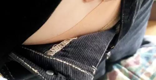 Customer photo review of Patchs huiles essentielles