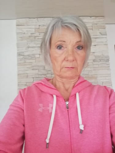 Customer photo review of Nachtcreme mit Hyaluron & Ceramiden | Night Cream