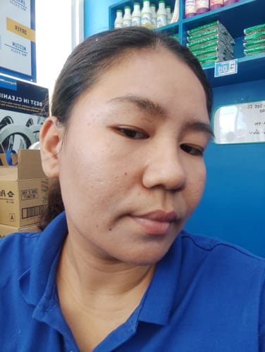 Customer photo review of Bad Skin™ Korean Collagen Bomb Hydrating Ampoule