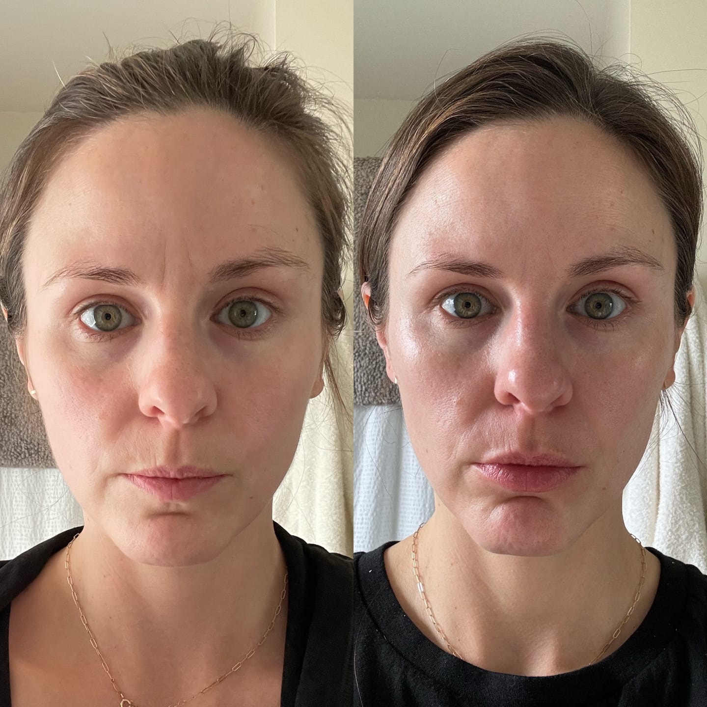 Customer photo review of GLOW WAND