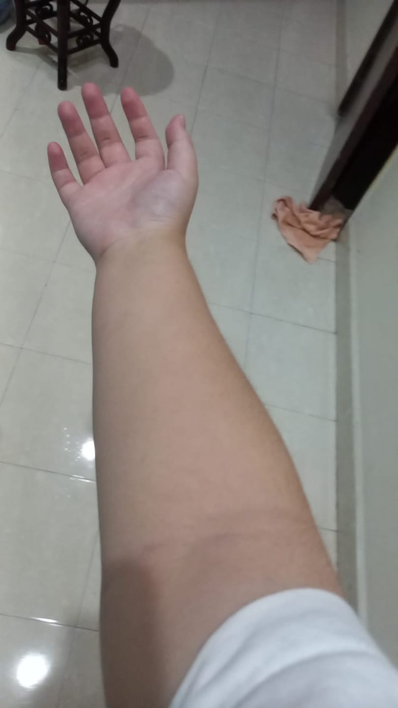 Customer photo review of DermaGen Manuka Balm
