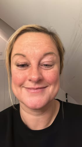 Customer photo review of QuickLash Starter Kit