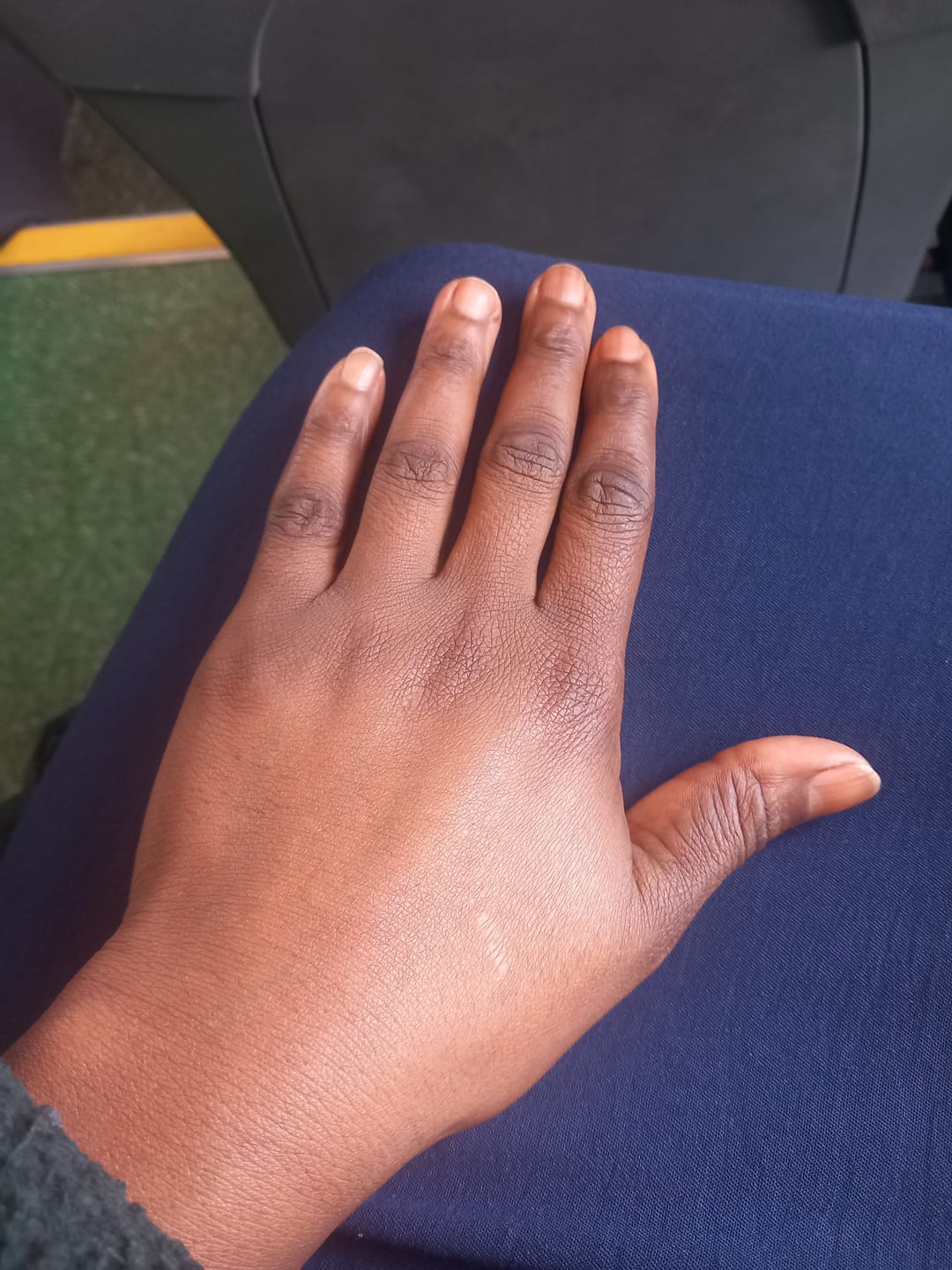 Customer photo review of Magix Cream