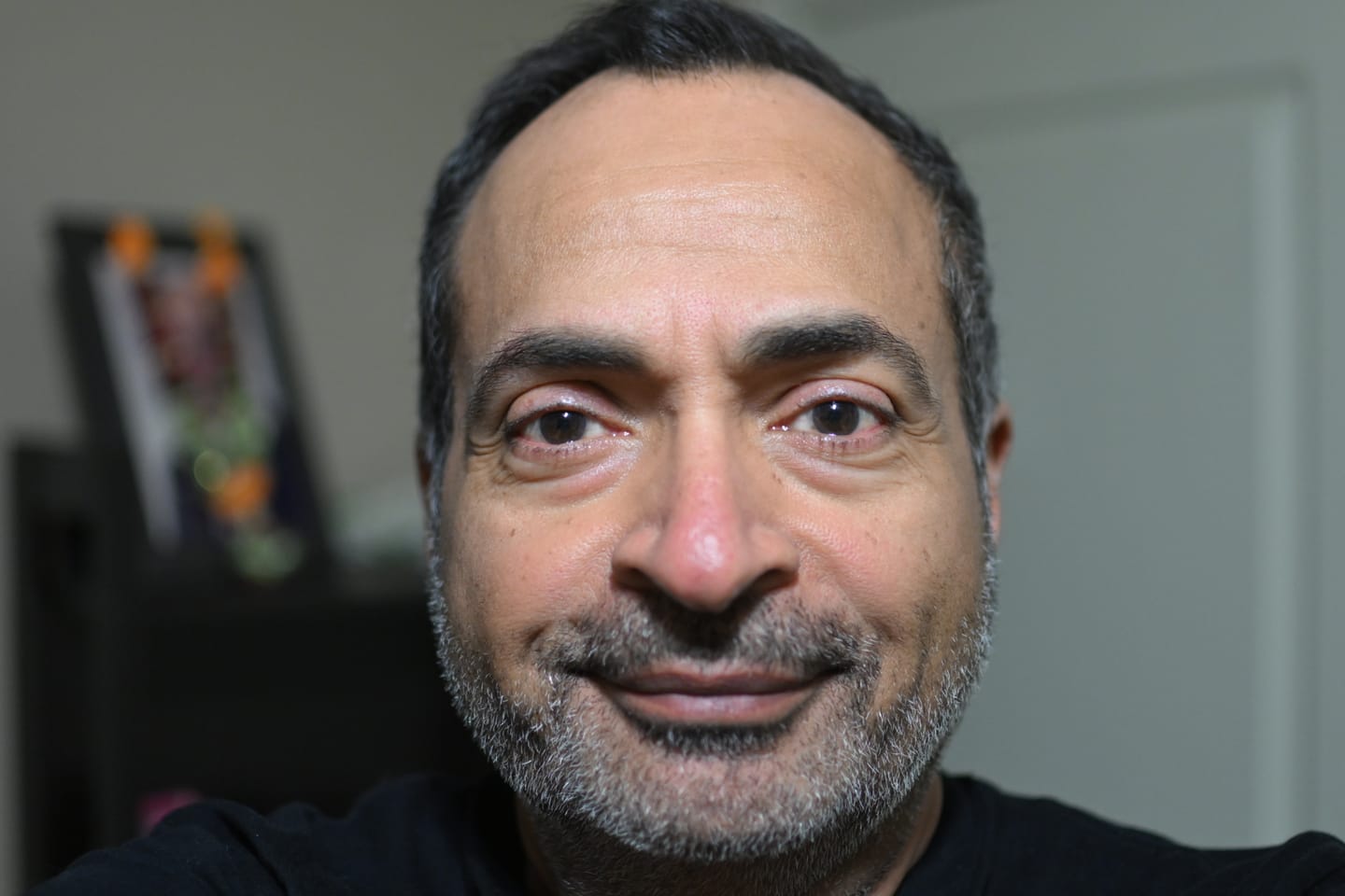 Customer photo review of Under Eye Tightener