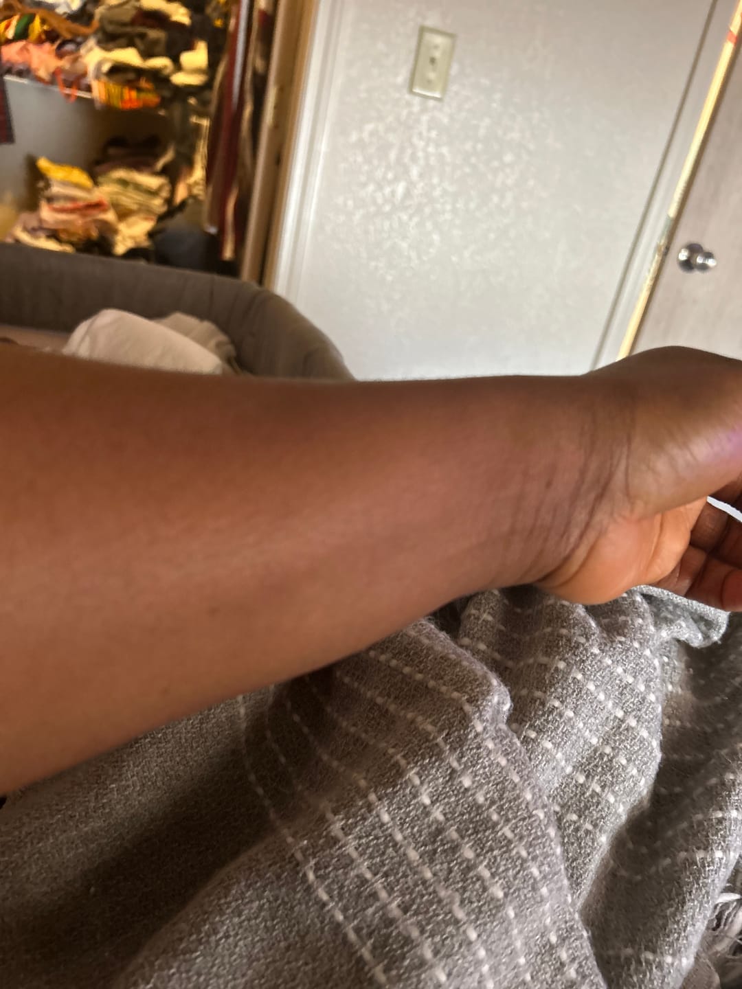 Customer photo review of Fair and White Miss White Body Lightening Lotion 7 days 500ml