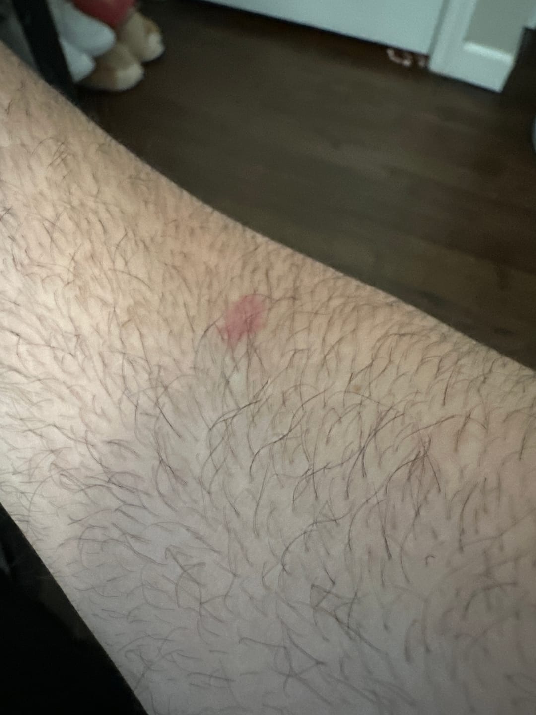 Customer photo review of Psoriasis Honey Renewing Conditioner