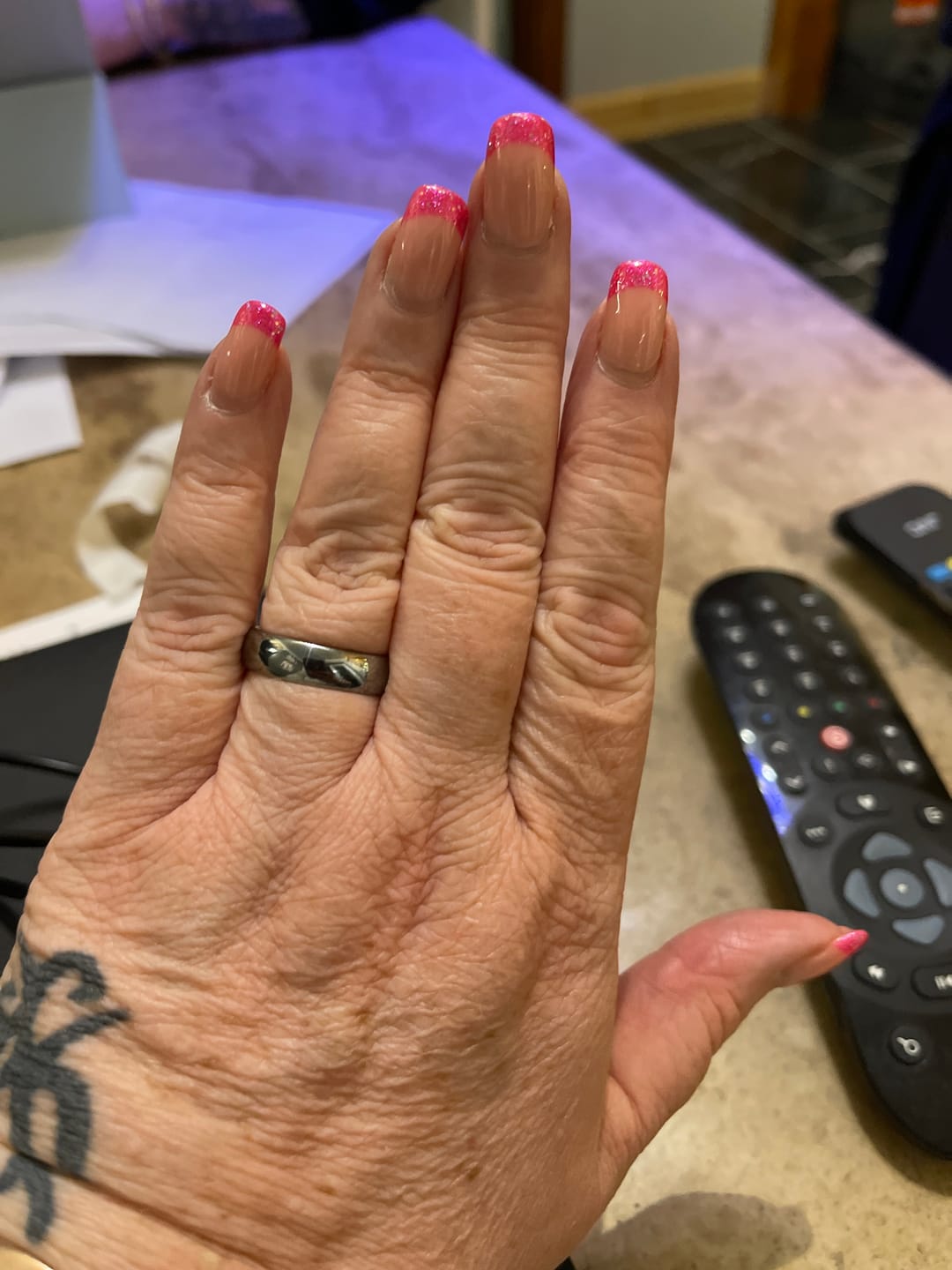 Customer photo review of Original 6mm Wonder Ring