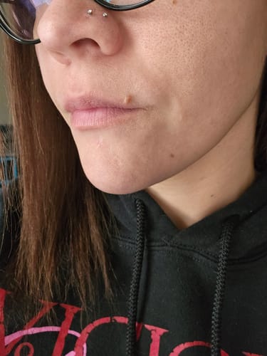 Customer photo review of Piercing Aftercare Saline Gel Swabs