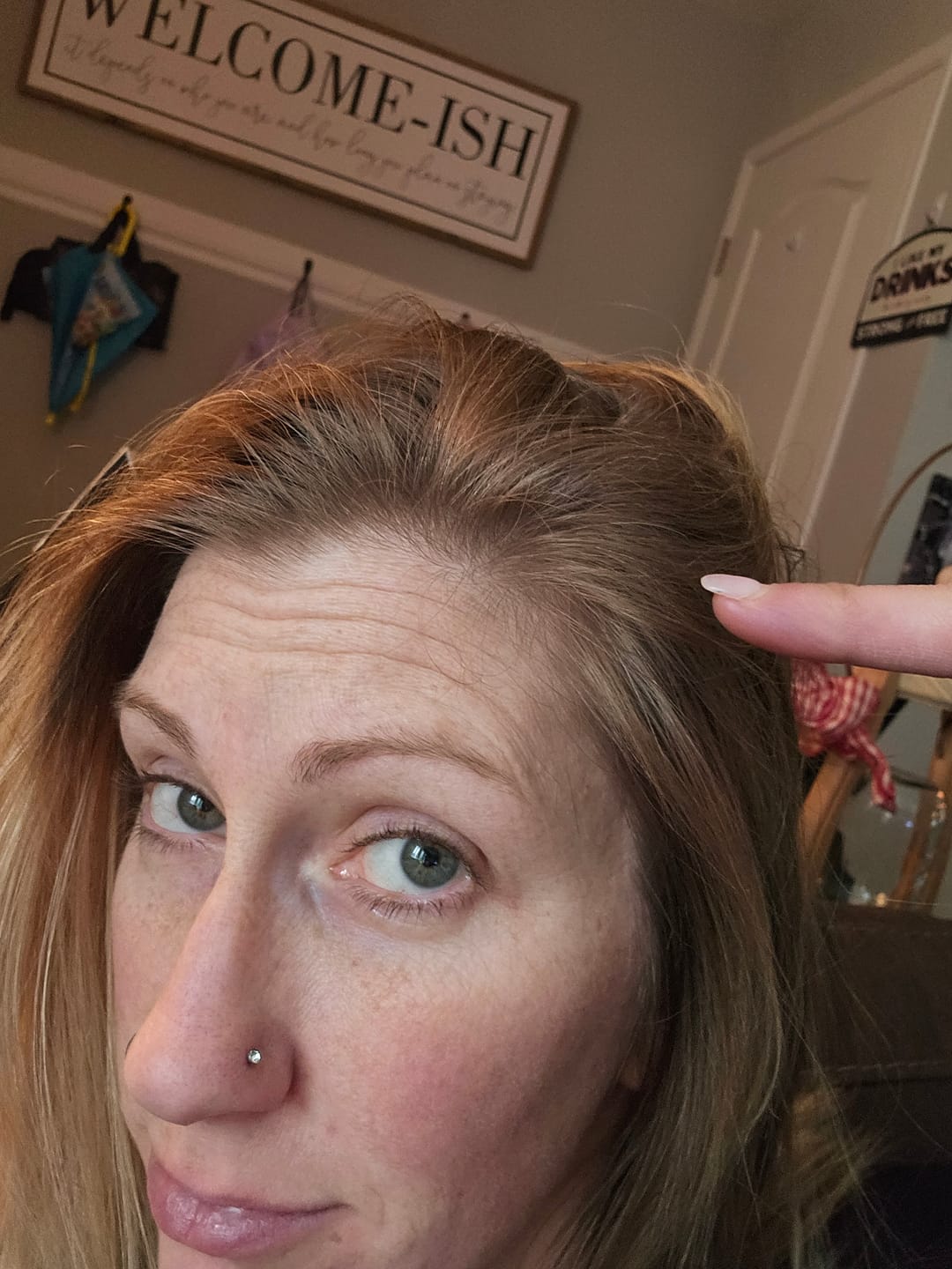 Customer photo review of HAIR GROWTH 15.00% Off Auto renew (Ships every 30 Days)