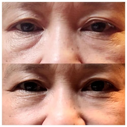 Customer photo review of Crème Anti Cernes et Rides Instantanée