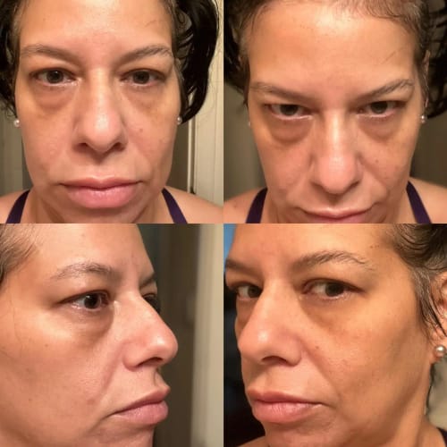 Customer photo review of Crème Anti Cernes et Rides Instantanée