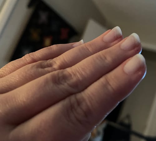 Customer photo review of Rocket Nail Fuel Nail Repair - Clear