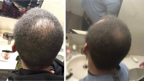 Customer photo review of India’s Secret Ancient Ayurvedic Hair Follicle Elixir (4 sizes)