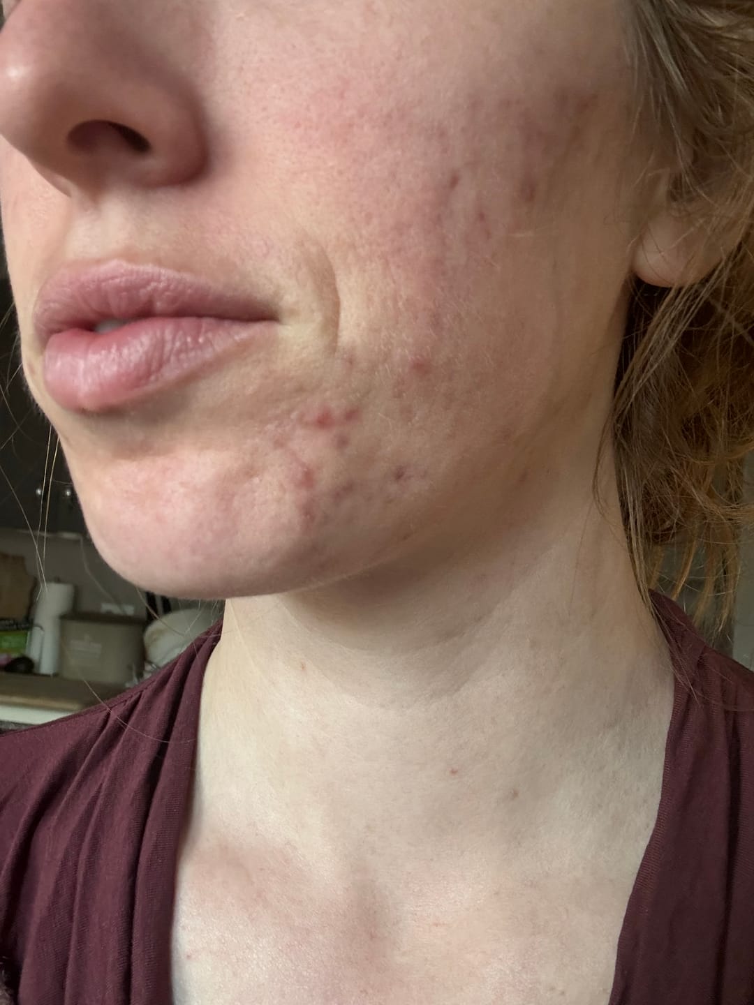 Customer photo review of aspenglow / restorative face whip kit